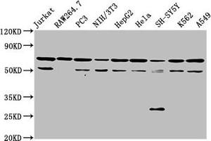 Western Blot Positive WB detected in: Jurkat whole cell lysate, RAW264. (NUP62 antibody  (AA 173-522))
