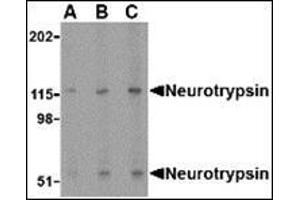 Western blot analysis of neurotrypsin in SK-N-SH cell lysate with this product at (A) 0.