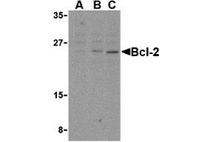 Western Blotting (WB) image for anti-B-Cell CLL/lymphoma 2 (BCL2) (Middle Region) antibody (ABIN1030884) (Bcl-2 antibody  (Middle Region))