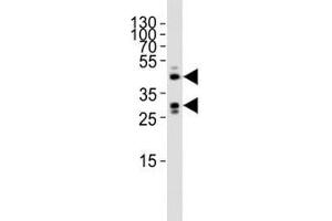 Western blot analysis of lysate from mouse heart tissue lysate using SIRT3 antibody diluted at 1:1000. (SIRT3 antibody  (AA 304-334))