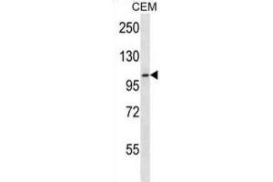 Western Blotting (WB) image for anti-Rhomboid 5 Homolog 2 (RHBDF2) antibody (ABIN2923970) (RHBDF2 antibody)