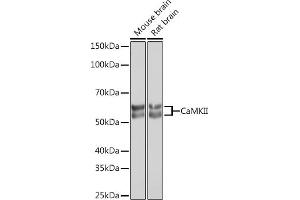 CAMK2B antibody