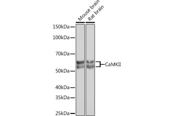 CAMK2B antibody