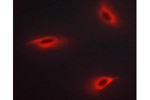 Immunofluorescence (fixed cells) (IF/ICC) image for anti-Insulin Receptor Substrate 1 (IRS1) (pSer312) antibody (ABIN6256264)
