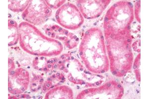 Human Kidney: Formalin-Fixed, Paraffin-Embedded (FFPE). (MAP1S antibody  (FITC))