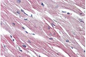 Heart, Human: Formalin-Fixed, Paraffin-Embedded (FFPE) (EPHX2 antibody  (C-Term))