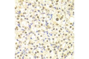 Immunohistochemistry of paraffin-embedded rat heart using DDB2 antibody at dilution of 1:100 (x400 lens). (DDB2 antibody)