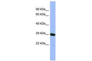 METTL5 antibody  (AA 35-84)