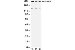 Western blot testing of ATM antibody and Lane 1:  rat testis;  2: U87;  3: MCF-7