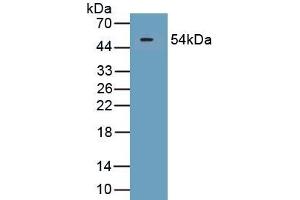 Detection of Recombinant SECTM1, Human using Polyclonal Antibody to Secreted And Transmembrane Protein 1 (SECTM1) (SECTM1 antibody  (AA 29-248))