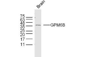 Mouse brain lysates probed with GPM6B Polyclonal Antibody, unconjugated  at 1:300 overnight at 4°C followed by a conjugated secondary antibody at 1:10000 for 90 minutes at 37°C.