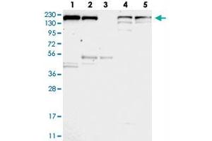 Western blot analysis of Lane 1: RT-4, Lane 2: U-251 MG, Lane 3: Human Plasma, Lane 4: Liver, Lane 5: Tonsil with UGCGL1 polyclonal antibody . (UGGT1 antibody)