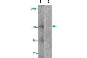 Western blot analysis of NLRP7 in human brain tissue lysate with NLRP7 polyclonal antibody  at 1 ug/mL in (1) the absence and (2) the presence of blocking peptide. (NLRP7 antibody  (N-Term))