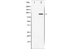 Western blot analysis of HSL expression in Jurkat whole cell lysates,The lane on the left is treated with the antigen-specific peptide. (LIPE antibody  (Internal Region))