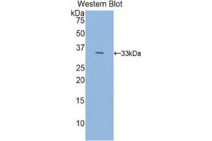 Western Blotting (WB) image for anti-Histidine Decarboxylase (HDC) (AA 365-643) antibody (ABIN1859133) (HDC antibody  (AA 365-643))