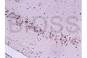 Formalin-fixed and paraffin embedded rat brain tissue labeled with Anti-Cygb Polyclonal Antibody (ABIN670566), Unconjugated at 1:200, followed by conjugation to the secondary antibody and DAB staining (CYGB antibody  (AA 87-132))