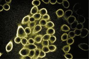 Immunofluorescent staining of Hela cells (Human cervical epitheloid carcinoma, ATCC CCL-2. (SPTBN1 antibody  (AA 2101-2189))