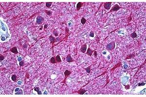 Human Brain, Cortex: Formalin-Fixed, Paraffin-Embedded (FFPE) (DPYSL2 antibody  (AA 480-529))
