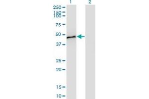 Western Blot analysis of CPB1 expression in transfected 293T cell line by CPB1 monoclonal antibody (M01), clone 4D5. (CPB1 antibody  (AA 14-417))