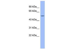 PTK6 antibody used at 1 ug/ml to detect target protein. (PTK6 antibody  (Middle Region))