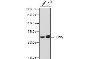 Western blot analysis of extracts of various cell lines, using TRPV6 antibody (ABIN7270921) at 1:1000 dilution. (TRPV6 antibody  (AA 1-100))
