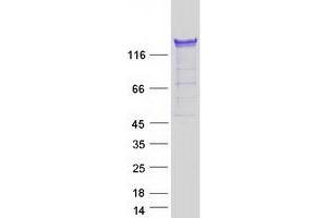 PUM1 Protein (Transcript Variant 2) (Myc-DYKDDDDK Tag)