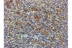 ABIN2563994 (4µg/ml) staining of paraffin embedded Human Tonsil. (MYD88 antibody  (Internal Region))