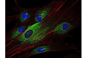 Immunofluorescence staining of Syk in human primary fibroblasts using anti-Syk (; green). (SYK antibody  (AA 5-360))