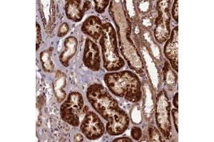 Immunohistochemical staining of human kidney with EARS2 polyclonal antibody  shows strong cytoplasmic positivity in renal tubules at 1:10 - 1:20 dilution.