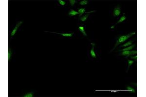 Immunofluorescence of purified MaxPab antibody to DYX1C1 on HeLa cell.