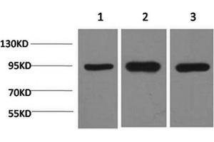 Western Blotting (WB) image for anti-Heat Shock Protein 90kDa alpha (Cytosolic), Class A Member 2 (HSP90AA2) antibody (ABIN5961311) (HSP90AA2 antibody)