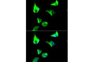 Immunofluorescence analysis of HeLa cell using RRM1 antibody. (RRM1 antibody  (AA 593-792))