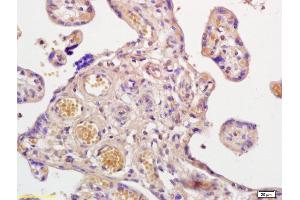 Formalin-fixed and paraffin embedded human placenta labeled with Anti-Prostaglandin E Receptor EP2 Polyclonal Antibody, Unconjugated (ABIN755248) at 1:200 followed by conjugation to the secondary antibody and DAB staining. (PTGER2 antibody  (AA 271-358))