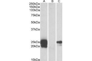 HEK293 lysate (10ug protein in RIPA buffer) overexpressing Human WFDC2 with C-terminal MYC tag probed with ABIN571149 (1ug/ml) in Lane A and probed with anti-MYC Tag (1/1000) in lane C. (WFDC2 antibody  (AA 29-43))