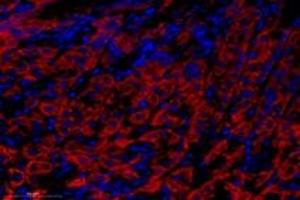 Immunofluorescent analysis of paraformaldehyde-fixed mouse stomach using Epsin-3 (ABIN7073856) at dilution of 1: 1400 (EPN3 antibody)