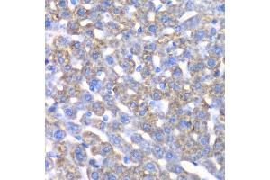 Immunohistochemistry of paraffin-embedded mouse liver using CCBL1 antibody.