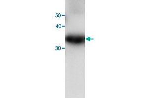 Western blot analysis of recombinant PRDX6 protein with PRDX6 monoclonal antibody, clone 36  at 1:1000 dilution. (Peroxiredoxin 6 antibody)