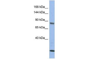 WB Suggested Anti-MAP3K11 Antibody Titration: 0. (MAP3K11 antibody  (Middle Region))