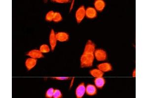 Immunofluorescence analysis of Hela cells using DNAJC19 Polyclonal Antibody at dilution of 1:100 (40x lens). (DNAJC19 antibody)