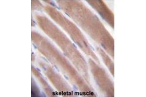 VEGF3 Antibody (N-term) immunohistochemistry analysis in formalin fixed and paraffin embedded human skeletal muscle followed by peroxidase conjugation of the secondary antibody and DAB staining. (VEGFC antibody  (N-Term))