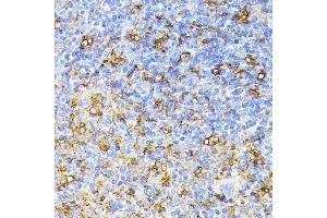 Immunohistochemistry of paraffin-embedded mouse spleen using FLT1 antibody (ABIN6132264, ABIN6140687, ABIN6140689 and ABIN6216515) at dilution of 1:100 (40x lens). (FLT1 antibody  (AA 20-300))