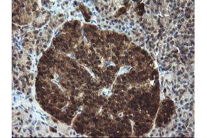 Image no. 1 for anti-Tubulin Folding Cofactor C (TBCC) antibody (ABIN1501323) (TBCC antibody)
