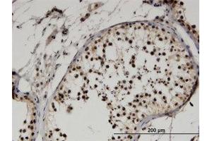 Image no. 2 for anti-F-Box Protein 9 (FBXO9) (AA 338-448) antibody (ABIN599547) (FBXO9 antibody  (AA 338-448))