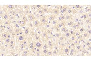 Detection of RBP2 in Mouse Liver Tissue using Polyclonal Antibody to Retinol Binding Protein 2, Cellular (RBP2)