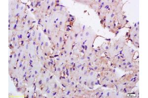 Formalin-fixed and paraffin embedded rat heart labeled with Anti-CD36/PAS-4 Polyclonal Antibody, Unconjugated (ABIN737661) at 1:200 followed by conjugation to the secondary antibody and DAB staining. (CD36 antibody  (AA 51-150))