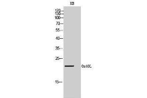 Western Blotting (WB) image for anti-Tumor Necrosis Factor (Ligand) Superfamily, Member 4 (TNFSF4) (Internal Region) antibody (ABIN6283257) (TNFSF4 antibody  (Internal Region))