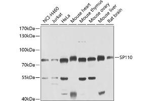 Western blot analysis of extracts of various cell lines, using SP110 antibody (ABIN6128744, ABIN6148311, ABIN6148313 and ABIN6223389) at 1:1000 dilution. (SP110 antibody  (AA 1-290))
