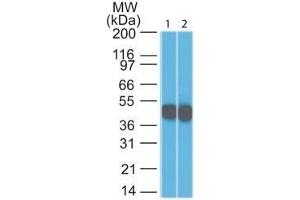 Western Blot Analysis (1) HeLa and (2) A431 lysate using Cytokeratin 18 Mouse Monoclonal Antibody (DC10). (Cytokeratin 18 antibody)
