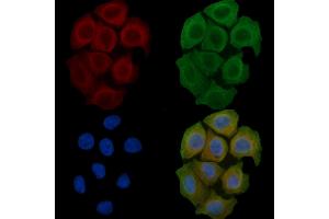 ABIN6259338 and ABIN6275436 staining Hela cells(45 min of heat-shock) by IF/ICC.