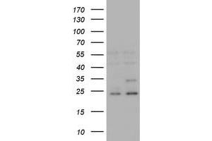 Image no. 4 for anti-RAB21, Member RAS Oncogene Family (RAB21) antibody (ABIN1500547) (RAB21 antibody)